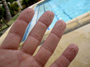 Wrinkled Fingers